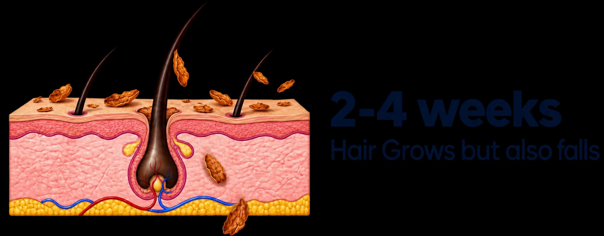 Hair growth during recovery