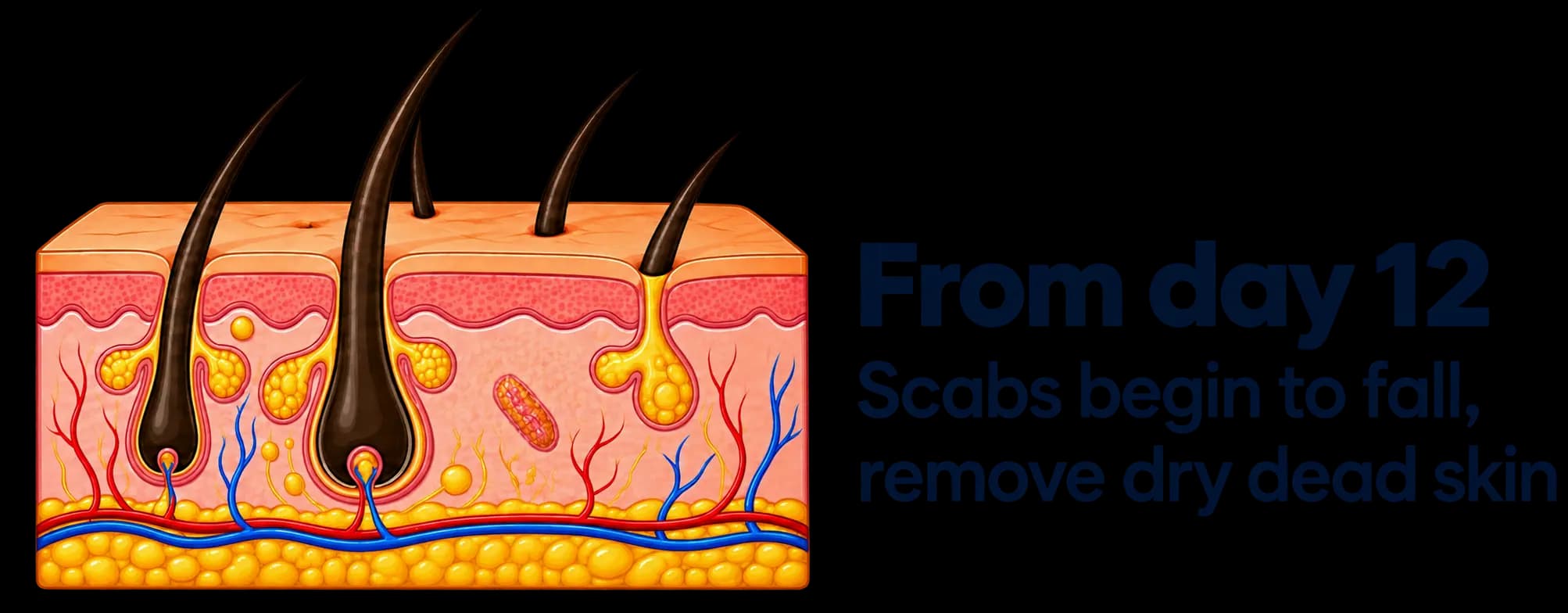 Scalp scabbing during recovery