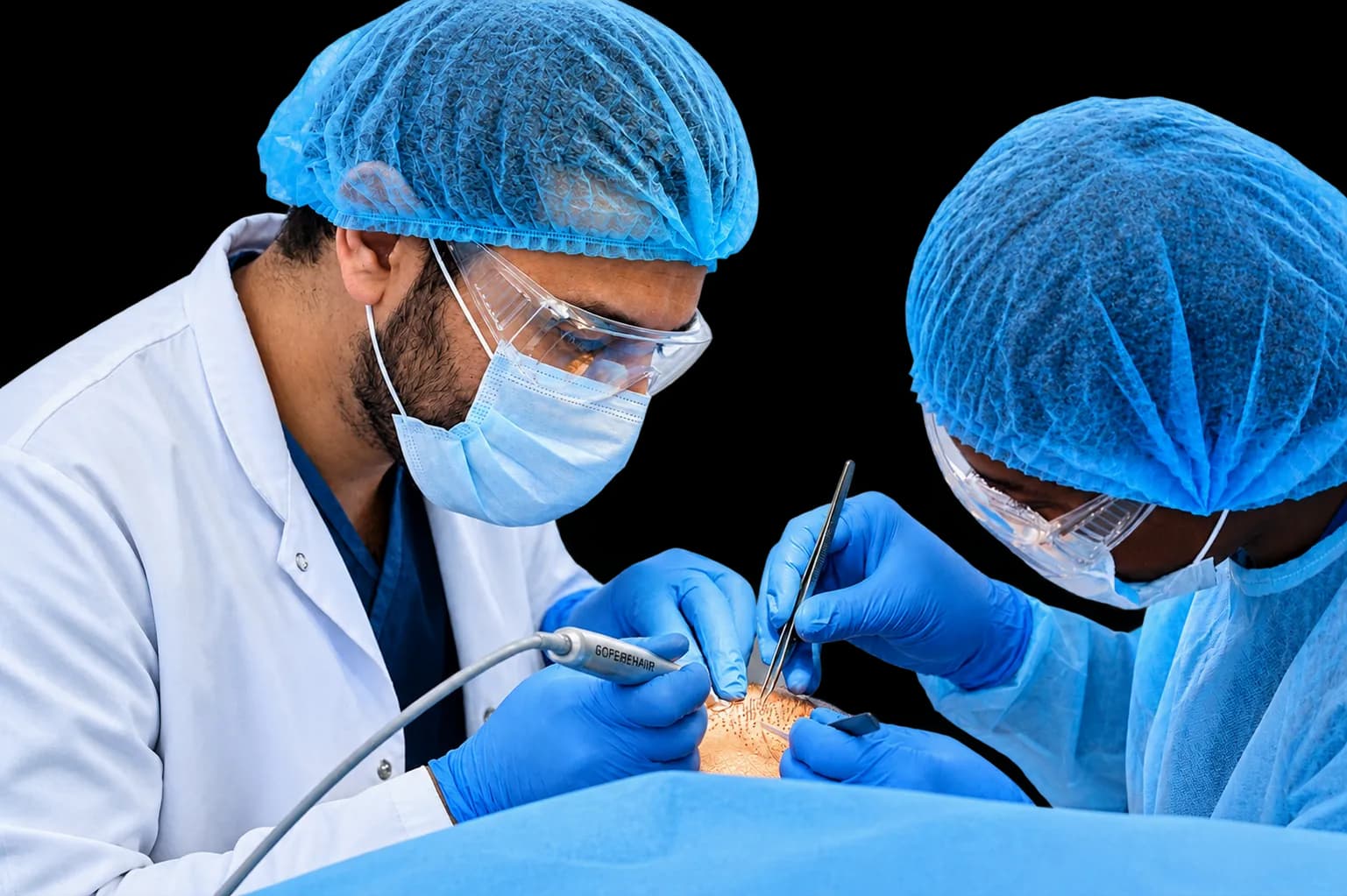 FUE hair transplant