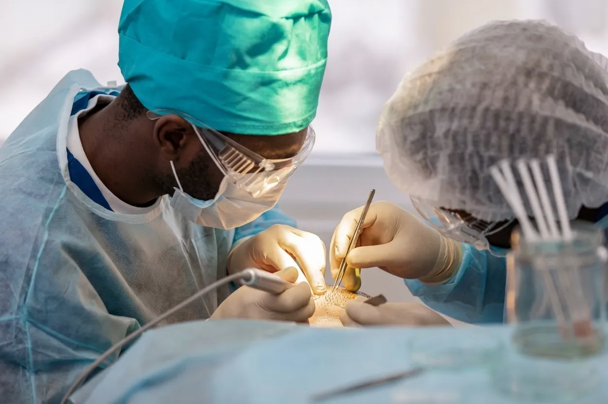 Goferie hair transplant